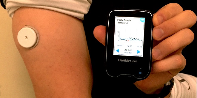 مقابله با بیماری دیابت با سیستم FreeStyle Libre Flash - تکفارس 