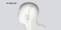 اولین آزمایش انسانی تراشه مغزی نورالینک ظرف چند ماه آینده انجام می شود - تکفارس 